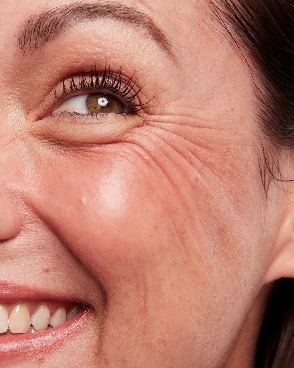 Close-up of bright, refreshed eyes after periorbital rejuvenation treatment