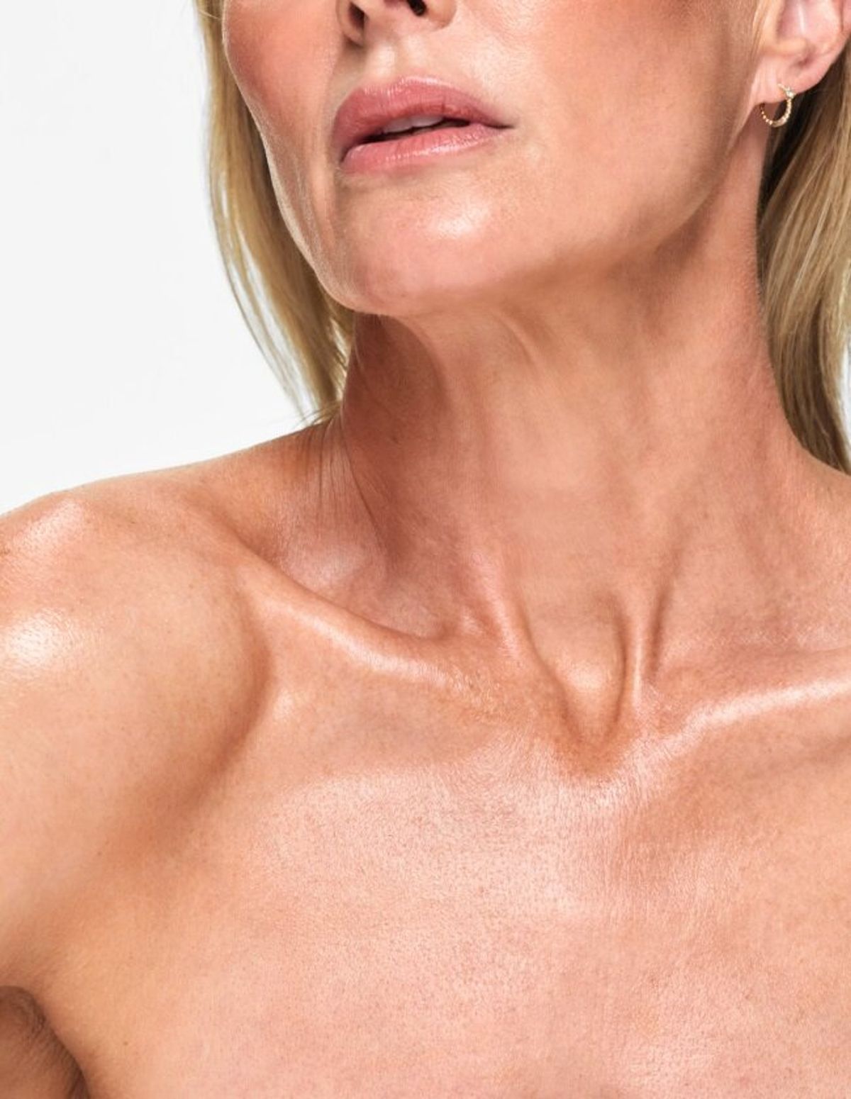 Woman with smooth, rejuvenated neck and jawline after treatment