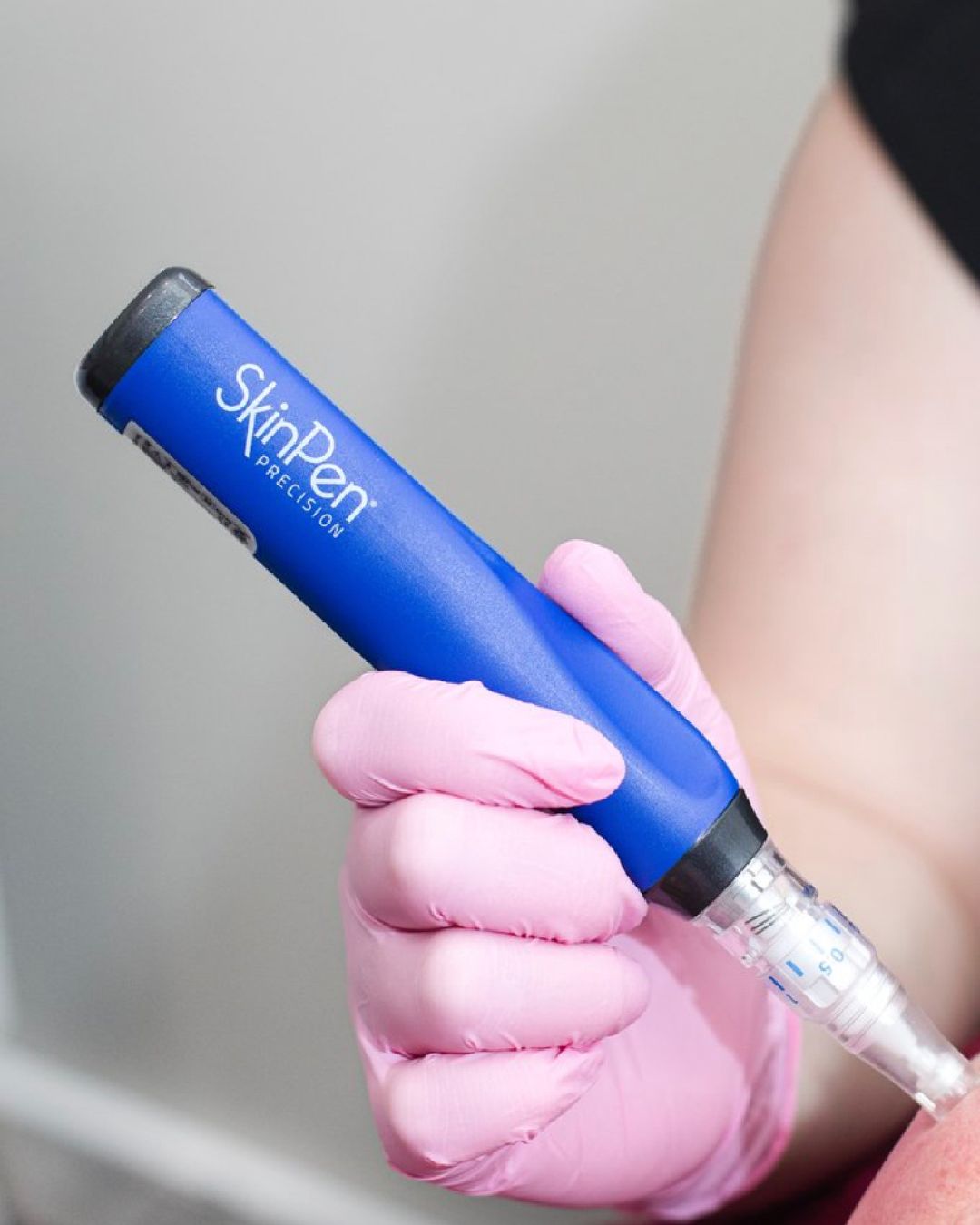 ExoGlow 4-in-1 Microneedling