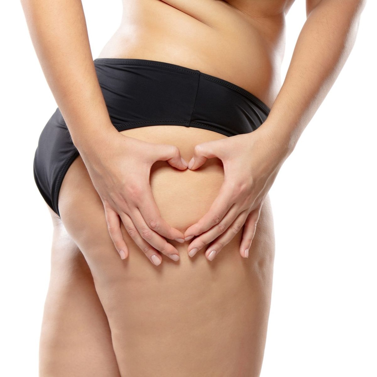Sculptra Cellulite treatment at Healing Aesthetics
