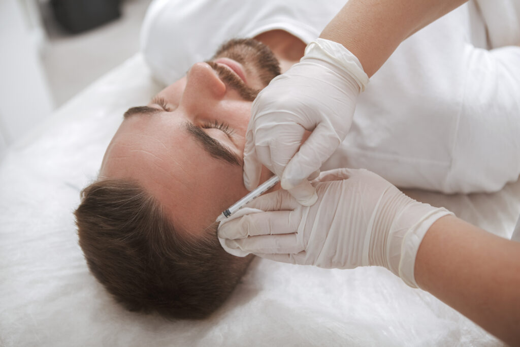 microneedling and PRP